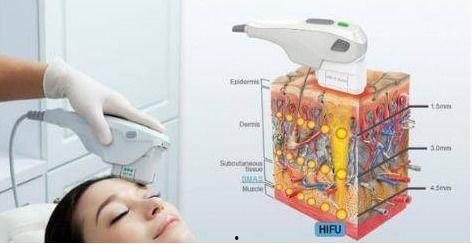 做超声刀视频,紧致肌肤的秘密武器